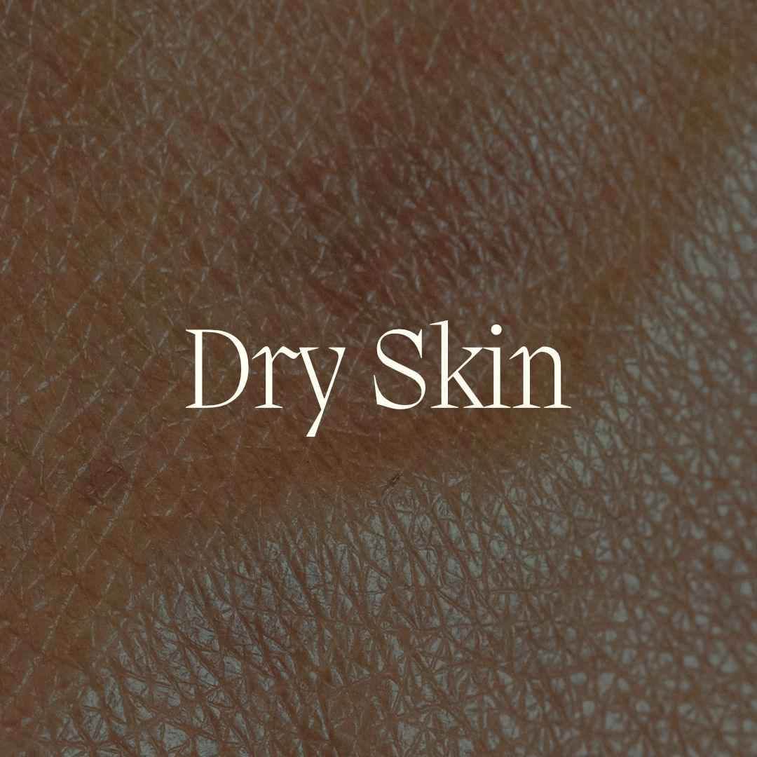 Formulations for Dry Skin - NamoMonk